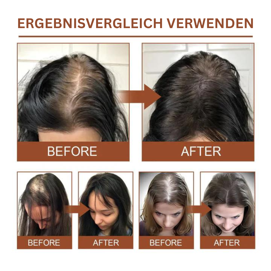 Letzter Tag 50% OFF🔥I HaarVital™ Batana Öl