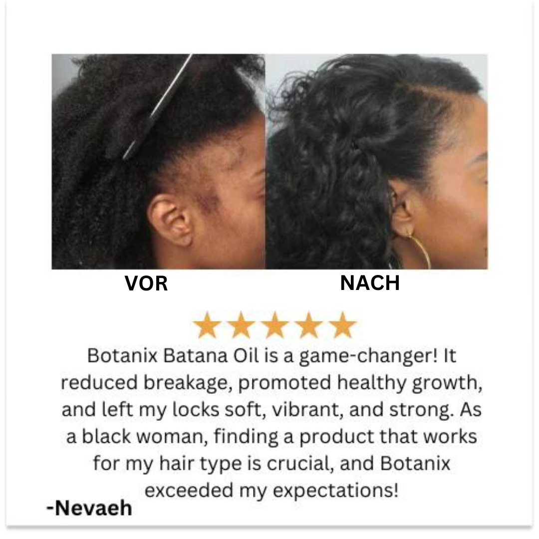 Letzter Tag 50% OFF🔥I HaarVital™ Batana Öl